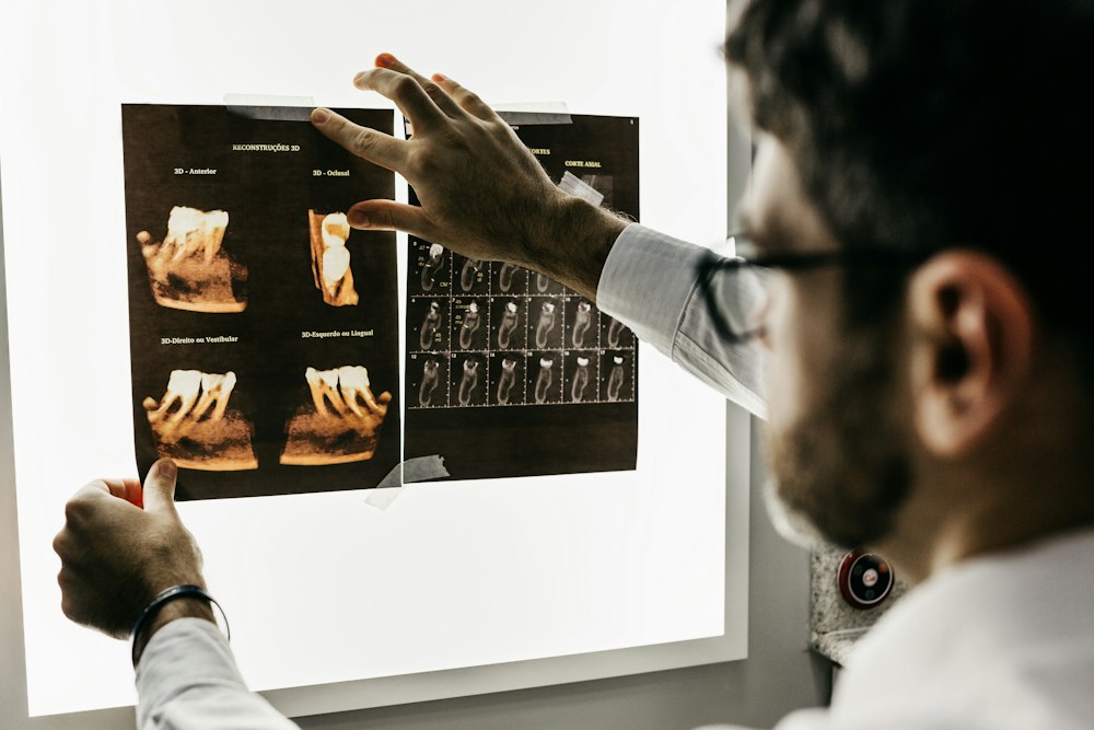 Dentist examining tooth X-rays